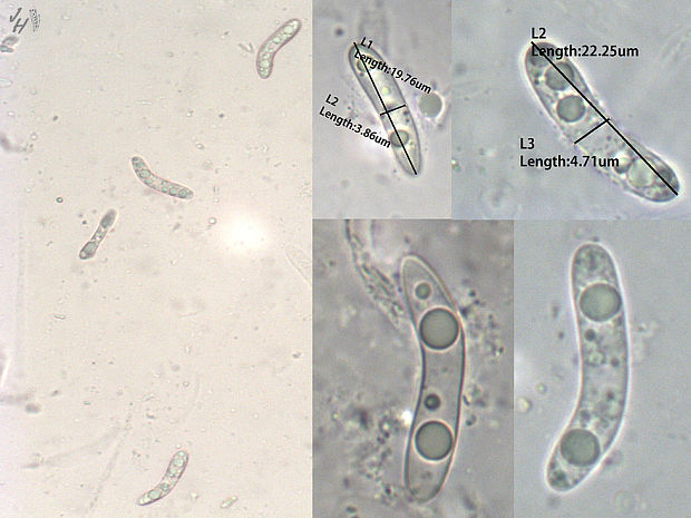 chlpatka Ruzenia spermoides (Hoffm.) O. Hilber