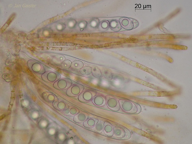 poháročka Leucoscypha ricciae (P. Crouan & H. Crouan) Dennis
