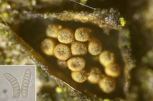 Thyronectria aurigera (Berk. & Ravenel) Jaklitsch & Voglmayr