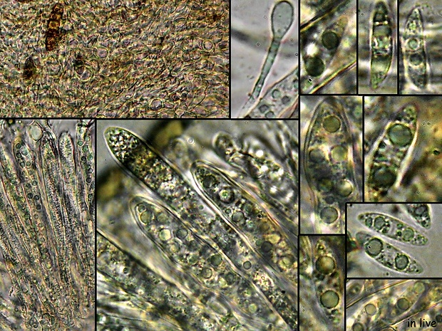 Micropeziza umbrinella (Desm.) Baral, Helleman & U. Lindem.