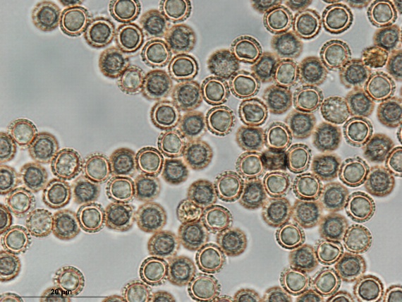 zlepníček jahodovitý - Rournatka rezavá Tubifera ferruginosa (Batsch) J.F. Gmel.