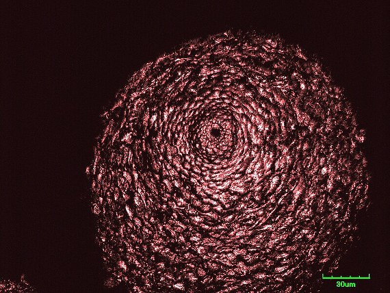 hlivka šarlátová/Rážovka červcová Neonectria coccinea (Pers.) Rossman & Samuels