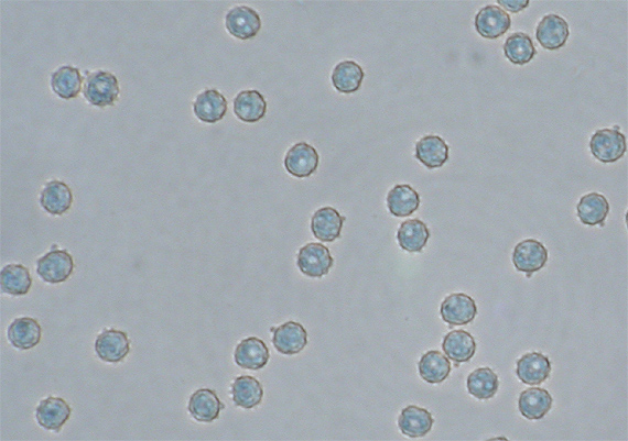 červenáčik obyčajný Rhodotus palmatus (Bull.) Maire