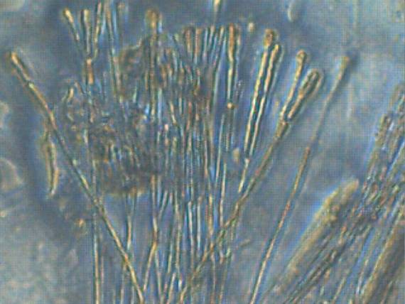míhavka tenkovýtrusá  Vibrissea leptospora  (Berk. & Broome) W. Phillips