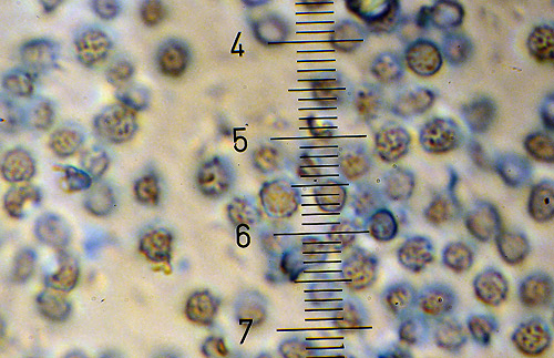 prašnačka korienkatá Gastrosporium simplex Mattir.