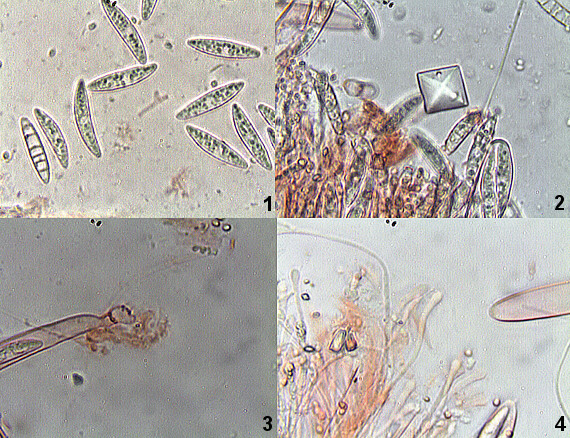 vrtidlovka veľkovýtrusná Ascocoryne cylichnium (Tul.) Korf