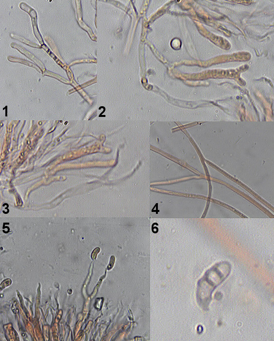 slzovec Dacrymyces lacrymalis (Pers.) Sommerf.