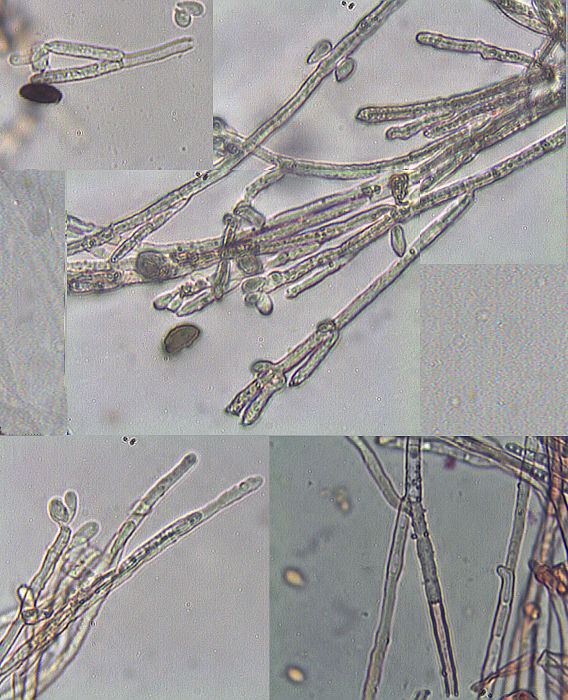 Calcarisporium arbuscula Preuss