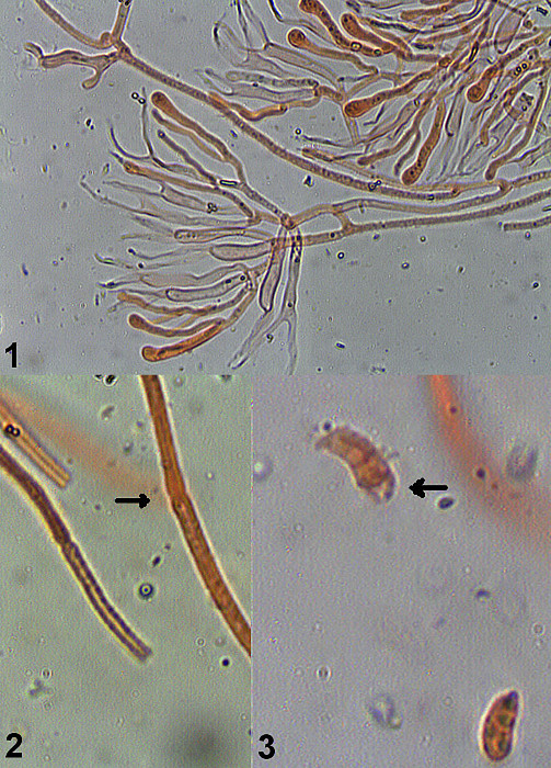 slzovec Dacrymyces lacrymalis (Pers.) Sommerf.