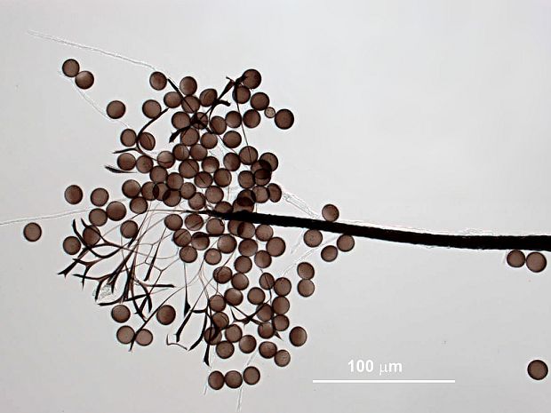 slizovka Paradiacheopsis fimbriata (G. Lister & Cran) Hertel ex Nann.-Bremek.