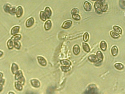 bedlica ružovolupeňová Leucoagaricus leucothites (Vittad.) Wasser
