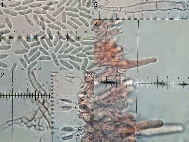 chrastuľka splývavá Megalocystidium leucoxanthum (Bres.) Jülich