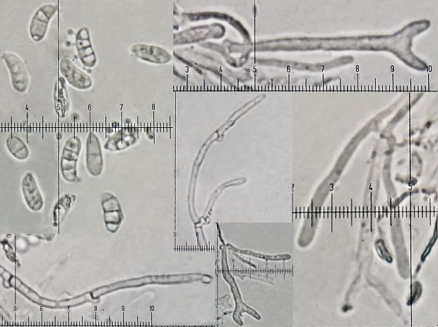 slzovec ihličnanový Cerinomyces tortus (Willd.) Miettinen, J.C. Zamora & A. Savchenko