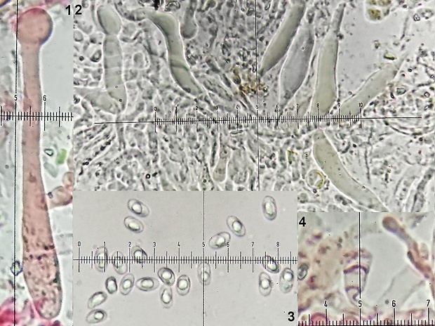 kožovka potrojná Peniophorella praetermissa (P. Karst.) K.H. Larss.