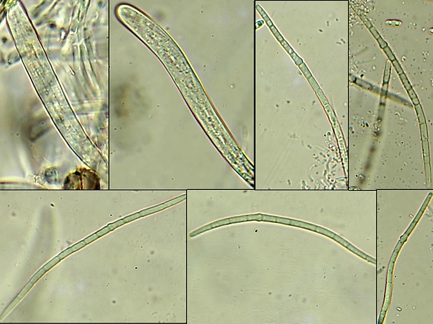 ofiobol Pseudoophiobolus erythrosporus (Riess) Phookamsak, Wanas., & K.D. Hyde 2017