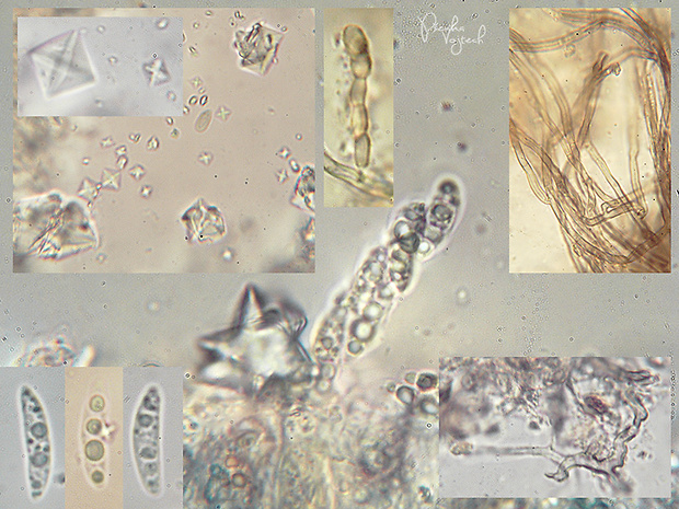 Xerombrophila crystallifera Baral, G. Marson & Unter.