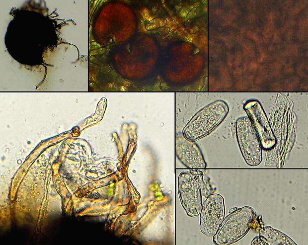 - Golovinomyces biocellatus (Ehrenb.) V.P. Heluta